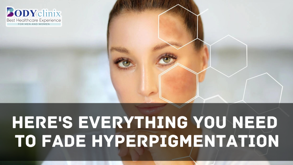 Here's Everything You Need to Fade Hyperpigmentation