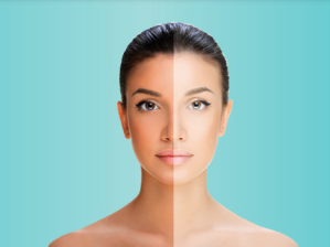 skin whitening in delhi